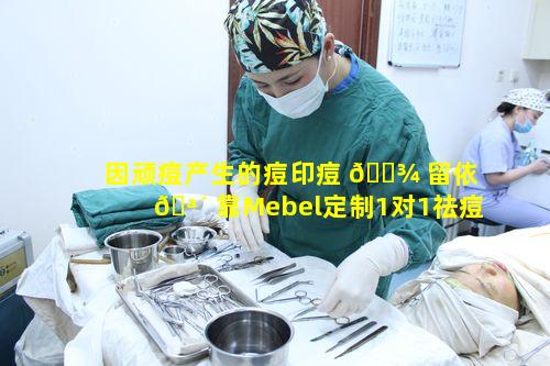 因顽痘产生的痘印痘 🌾 留依 🪴 靠Mebel定制1对1祛痘疤有何优势